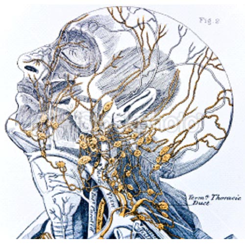 Neck-Mass-ENT-doctor-la
