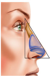 ENT Nose
