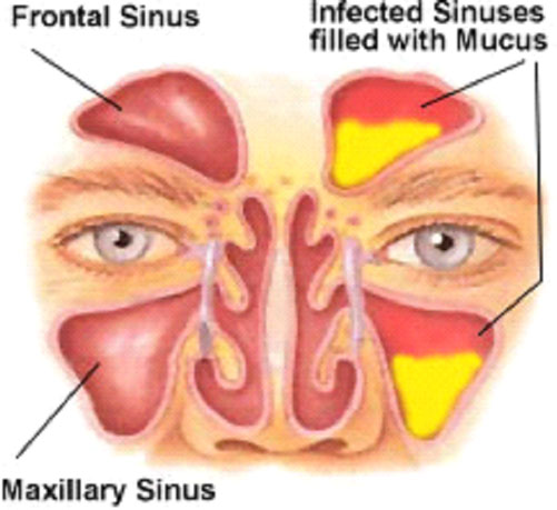 Nose-and-Sinus-Surgery-ENT-Doctor-LA