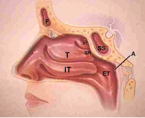 Nose-and-Sinus-Surgery-ENT-Doctor-LA