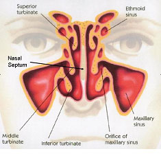 Septoplasty-at-ENT-Doctor-L.jpg