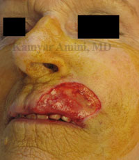 lip-large-2-B