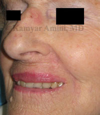 lip-large-3-B